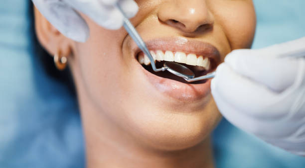 Best Emergency Gum Treatment in West Bountiful, UT