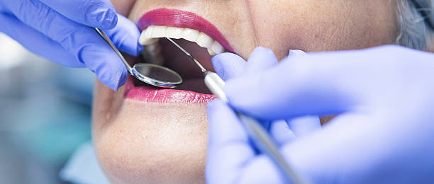 Best Emergency Dental Care for Broken or Chipped Teeth in West Bountiful, UT